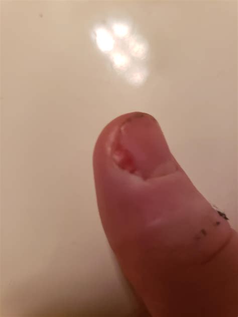 Nail Rising From Bed at Elijah Byrnes blog