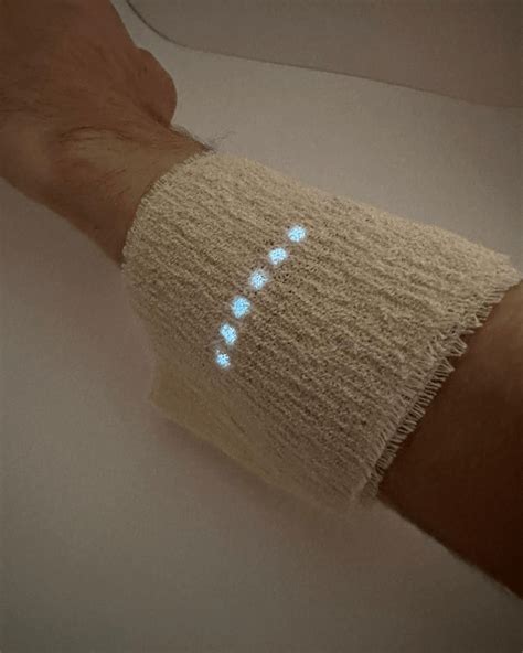 傷が早く治る「スマートばんそうこう」 実現近づく - WSJ