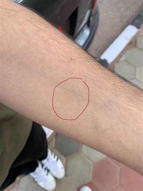 Sudden skin yellowing and yellow spots. Should my bf (26 m) be concerned? : r/medical