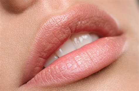 Prevent Cracked Lips - Cosmetics and Beauty