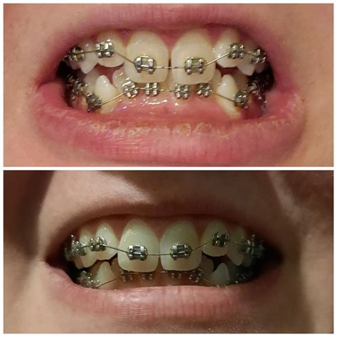 Three week progress! | Scrolller