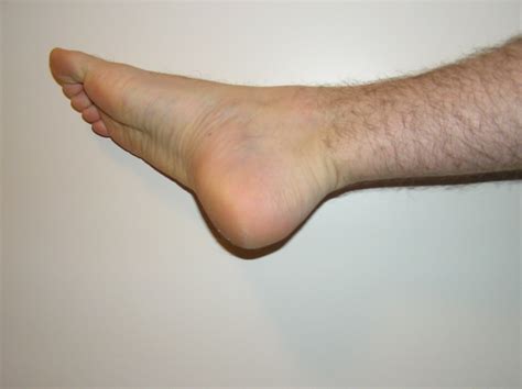 step   foot care game   guide  healthy feet