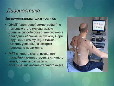 Острый миелит - презентация онлайн