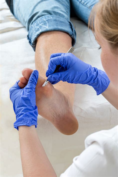 Woman receiving podiatry treatment- podiatrist chiropodist cleaning