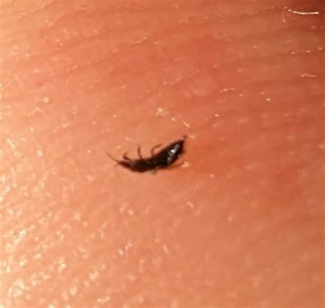 Does anyone know what bug this is? : r/Lice