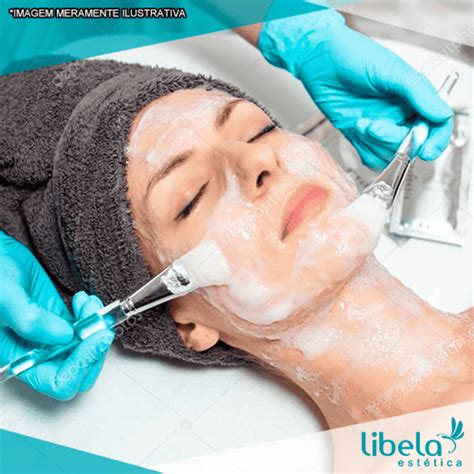 Limpeza De Pele E Peeling De Diamante - Limpeza de Pele e Peeling Diamante - LIBELA ESTÉTICA