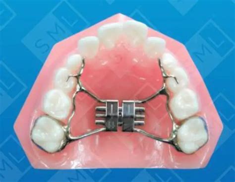 rapid palate expander  kids  adults complete guide