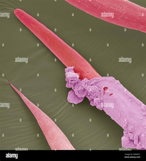 Phasmarhabditis hermaphrodita. Coloured scanning electron micrograph ...