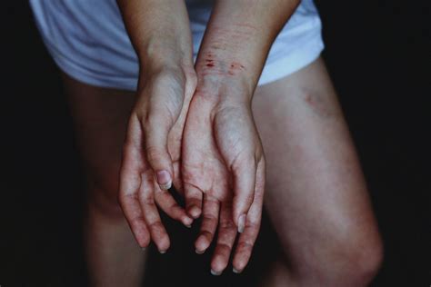 Laws to protect victims of domestic abuse are finally going to change