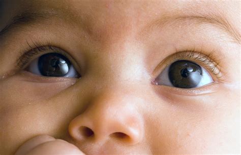 newborn eyes sticky eyes  babies  treatment remedies