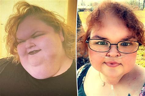 I had weight loss surgery here s what honey boo boo and everyone gets ...
