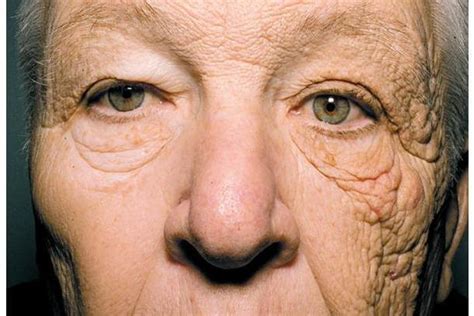 This photo shows what 28 years of sun damage does to your face | The Independent