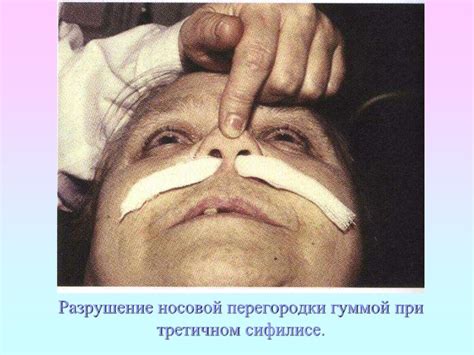 Заболевания, передающиеся половым путем, и их профилактика ...