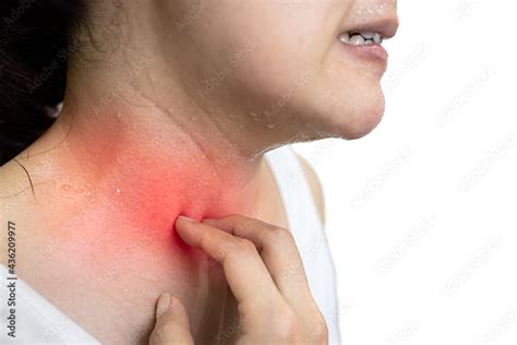 Asian woman scratching an itchy area that is sweating from hot weather,an allergic reaction to ...