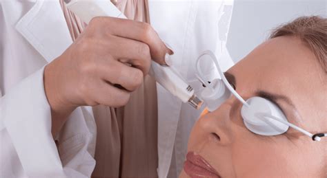 optima ipl meibomian gland dysfunction ipl treatment