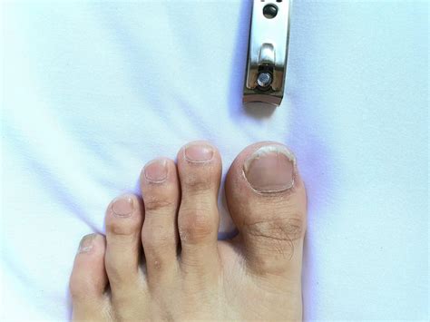 Nail Cutting For The Elderly: How to Make It Safe and Comfortable