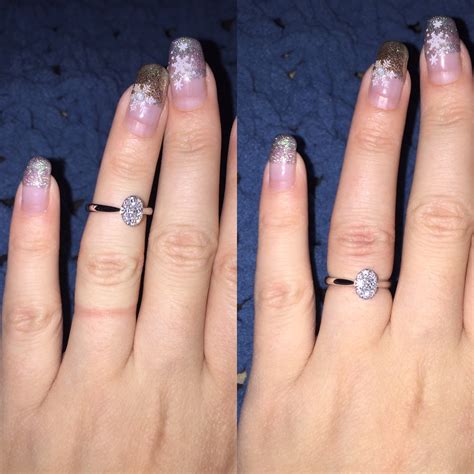 how to remove a ring from a swollen finger
