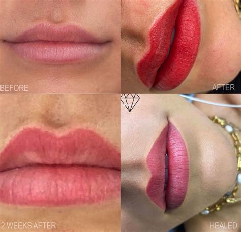 Jw Woodward: Before & After Results That Will Shock You Image 1