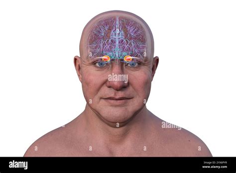 Computer illustration of the human brain with a highlighted amygdala ... 