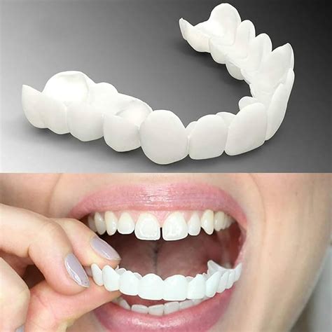 wttfc clip  teeth  pairs  fake teeth perfect smile veneers snap