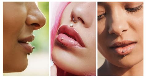 Vertical Labret Piercing Scar