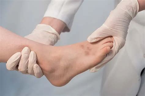 how long do avulsion fractures take to heal