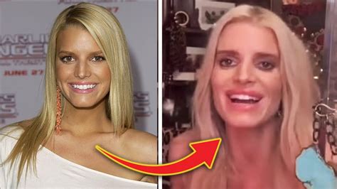 Jessica Simpson's Face Looks WILDY Different: WEIGHT LOSS or Plastic Surgery? - YouTube