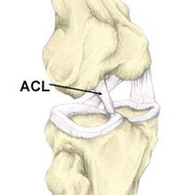 Art/Yoga Fusion: ACL vs PCL?