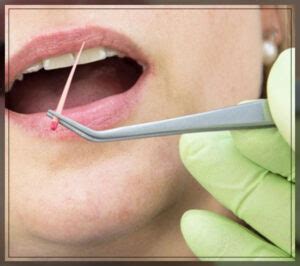 dental gutta percha   benefits engiomed