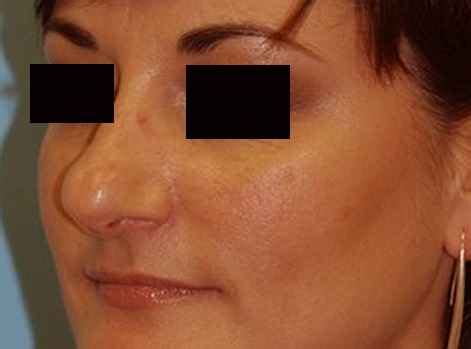 How To Slim A Bulbous Nose With Makeup - Mugeek Vidalondon