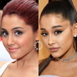 Ariana Grande Plastic Surgery: Facts, Rumors, and Transformations ...