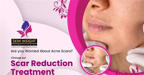 scar treatment scar removal procedures  cuddalore skin insight