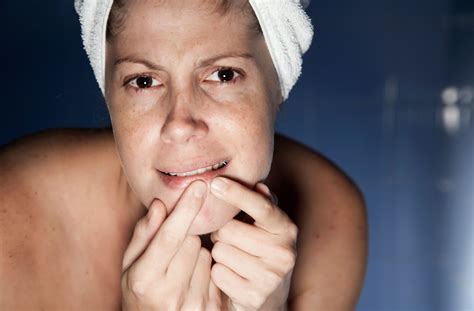 What Dermatologists REALLY Think About Unbelievable Blackhead Removal 2024! Image 20