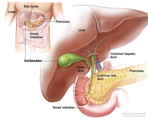Gallbladder Cancer | General Surgery