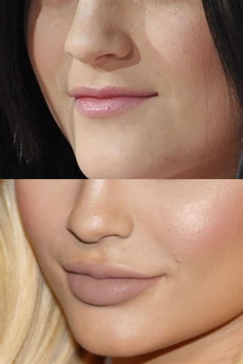 Imagefap Celebrities: Before And After – You Decide! Image 1