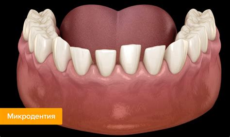 ТОП-15 самых частых болезней зубов | Журнал Startsmile о стоматологии ...