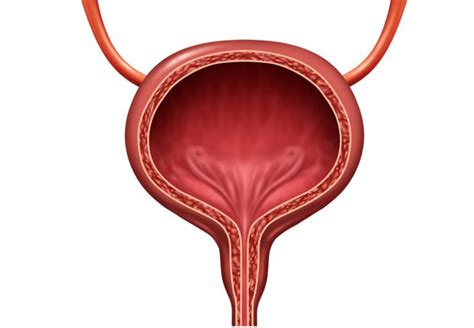 Artificial Urinary Sphincter