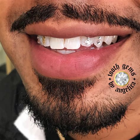 Best Gold Teeth at Danielle Oxford blog