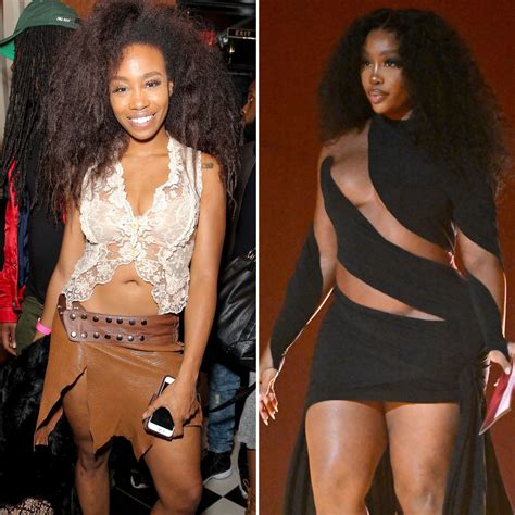 Did SZA Get Plastic Surgery? Transformation Photos, Quotes | Life & Style