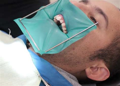 Estética Dental & Diseño de Sonrisa en Quito | Clínica Dental Novulis