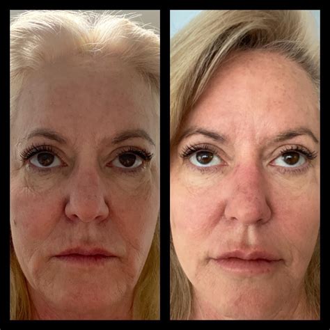 Taft Aesthetics LLC – Wilson NC 27893