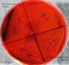 congo red    price  mumbai maharashtra arnish laborates