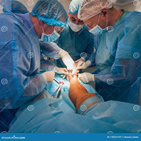 Process of Trauma Surgery Operation. Group of Surgeons in Operating
