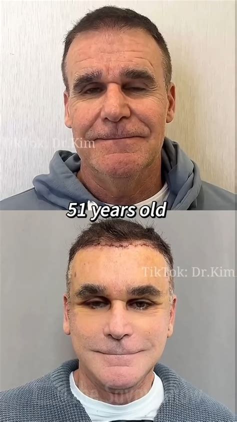Awful Face Transformation : r/sadcringe
