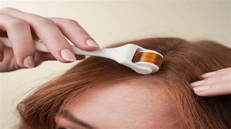 derma roller  hair growth healthshots