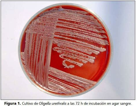 Oligella (bacterium) - Alchetron, The Free Social Encyclopedia