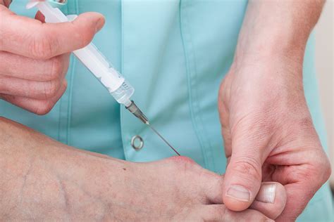 Prolotherapy — My Family Podiatrist