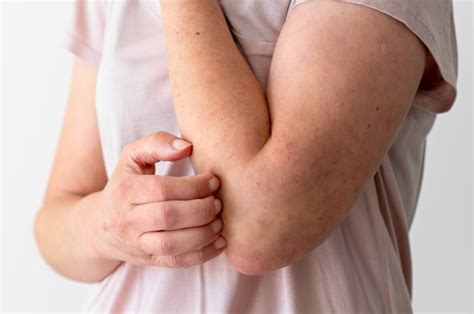 menghilangkan gatal secara alami  cepat natural farm indonesia