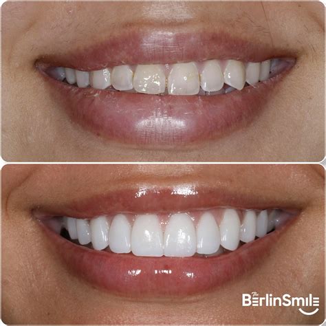 Course Registration - Online Dental Photography