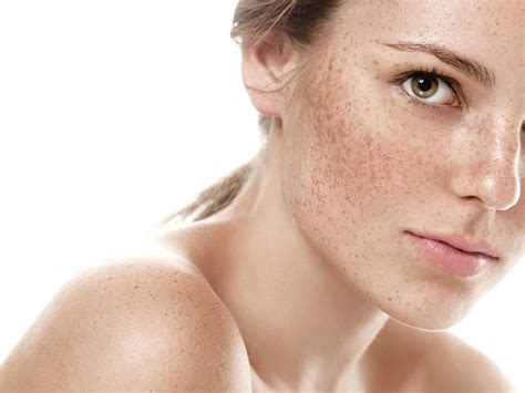 Are You Struggling with Scars & Pigmentation Spots? Give the Fractional ...